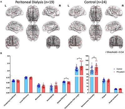 Changes of Brain Functional Connectivity in End-Stage Renal Disease Patients Receiving Peritoneal Dialysis Without Cognitive Decline